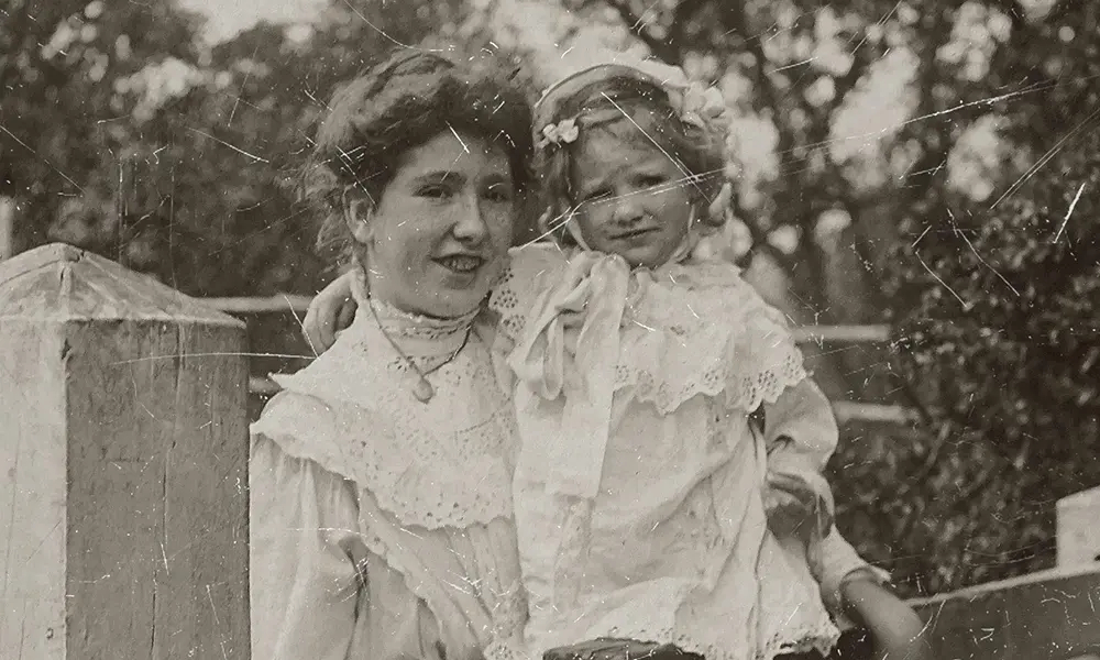 Before - Damaged Facial Features